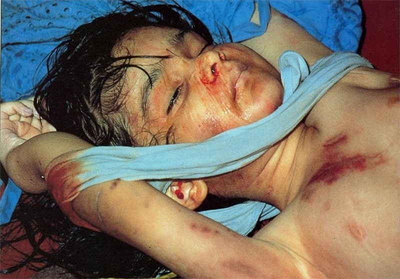 شهدای دفاع مقدس , دفاع مقدس , آمریکا , 