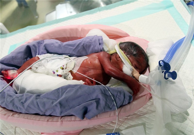 3 نوزاد از 6قلوهای مشهدی فوت شدند