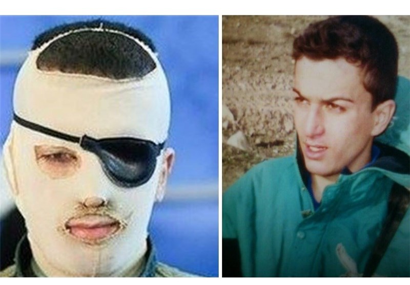 حکم آزادی عامل اسیدپاشی به داود روشنایی صادر شد