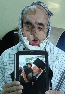 جانبازان مدافع حرم , جانبازان دفاع مقدس , جانبازان اعصاب و روان , جانبازان شیمیایی , 