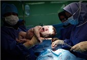 چرا آمار عمل "سزارین" در ایران بسیار بالاتر از نرم جهانی است؟!/ خطرات جدی سزارین برای مادر