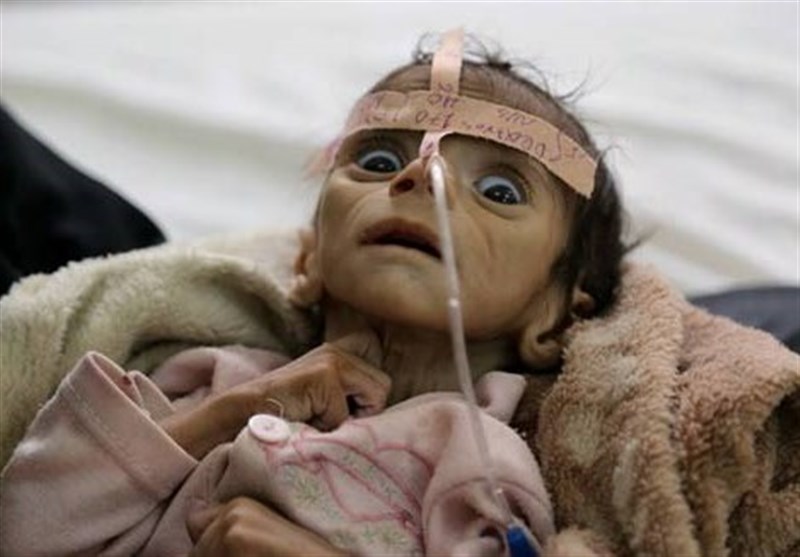 Batı Yemen'de Yaşananları Görmezden Gelmekte