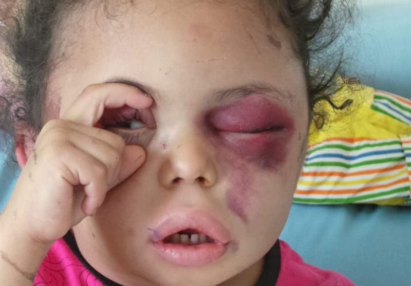 عربستان سعودی , کشور یمن ,