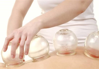 صفر تا صد آنچه باید درباره "حجامت" بدانید!/ آخرین فرصت برای پاکسازی بدن در فصل بهار