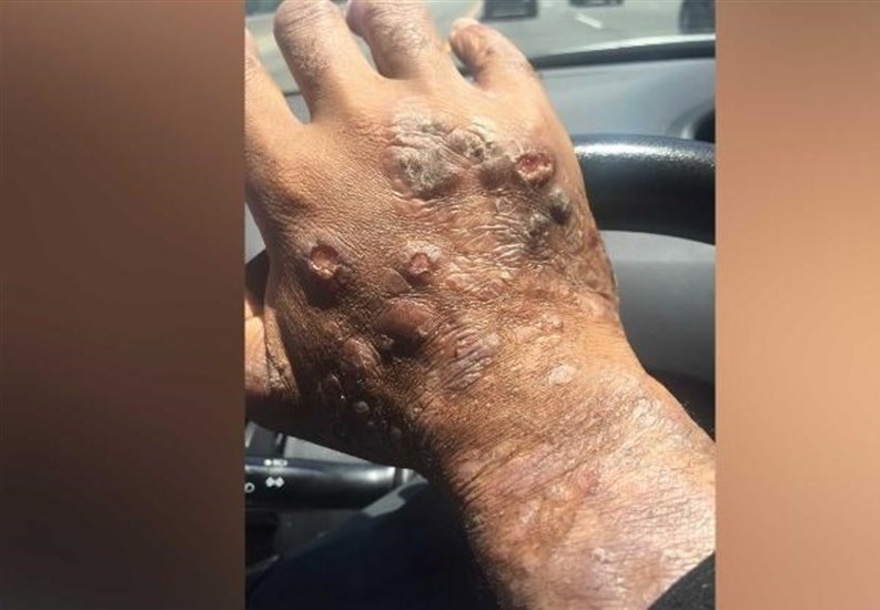 قاره آمریکا , محصولات تراریخته , 