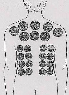 ویروس کرونا , 