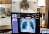 اهمیت به‌روزرسانی تجهیزات تصویربرداری پزشکی/ علت خروج برخی تجهیزات از چرخه درمان