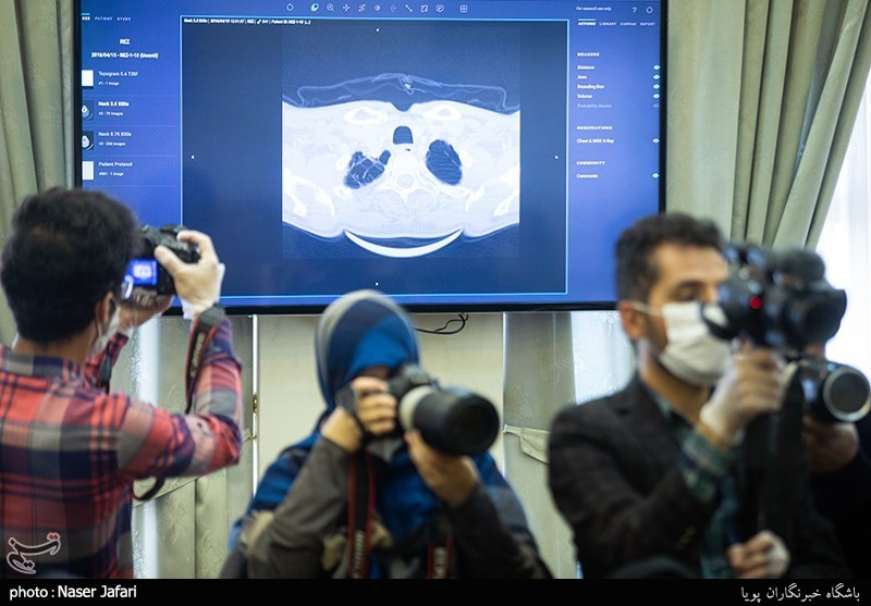 رونمایی از سامانه تشخیص پونومی Covid 19