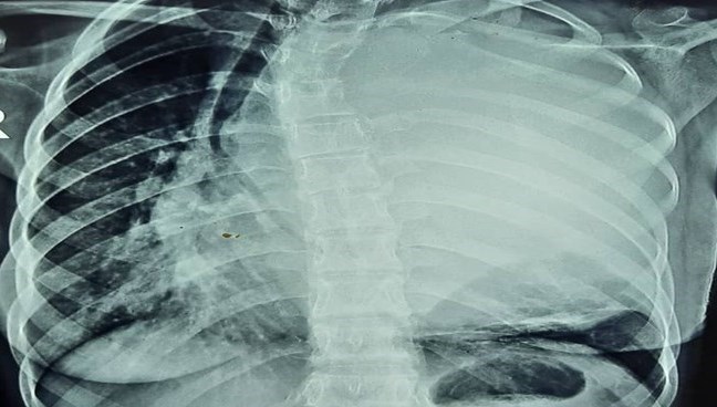 استان سیستان و بلوچستان , بیمارستان , 