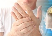 طب ایرانی مکمل درمان ام‌اس است، نه جایگزین آن