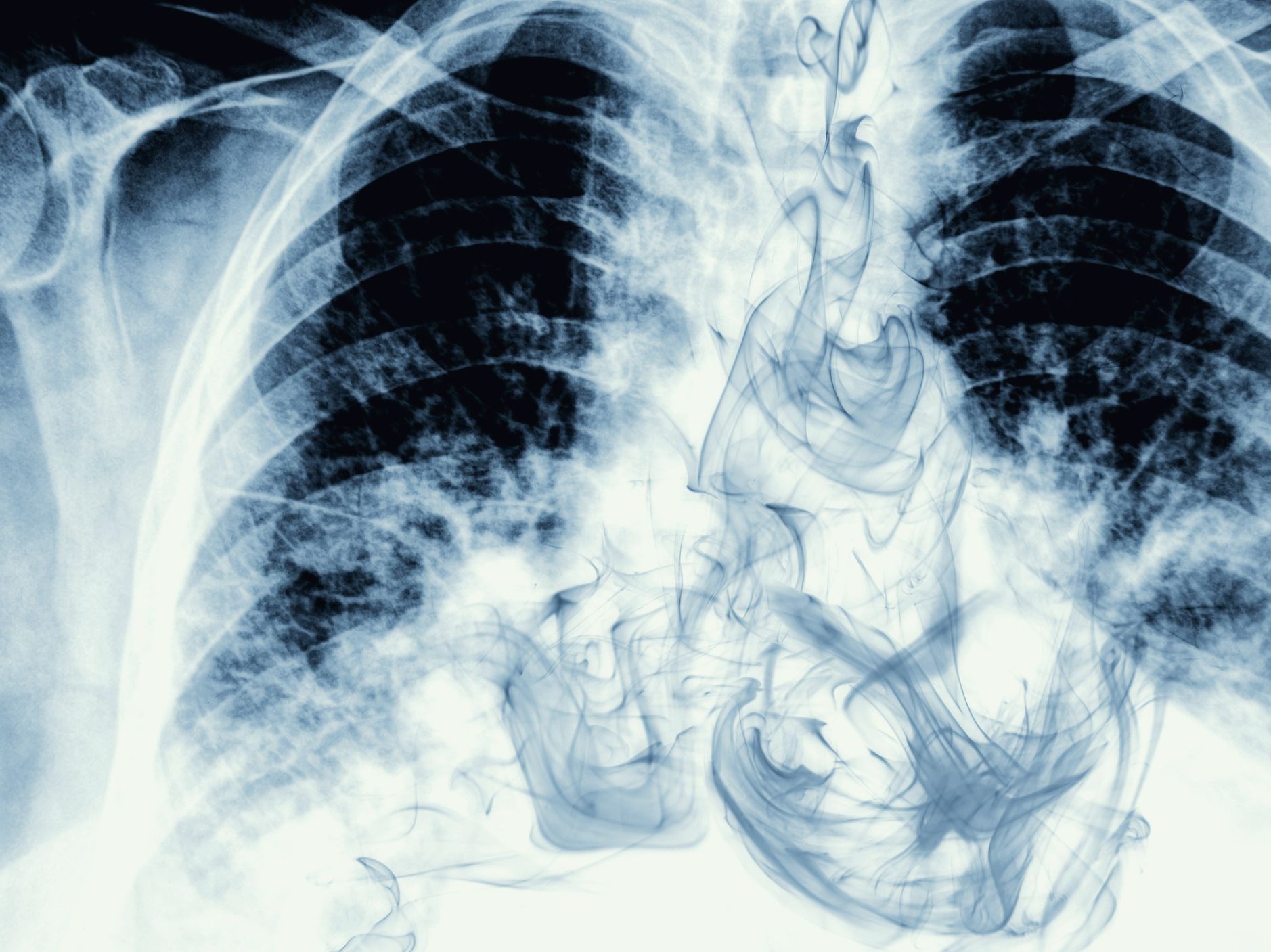 کرونا , مواد مخدر ,