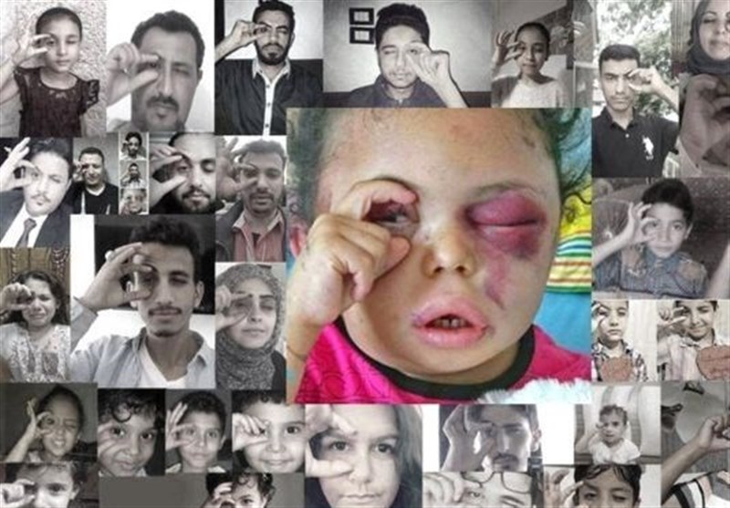 کشور یمن , عربستان سعودی , 