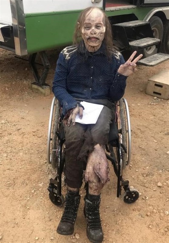 ورزش , ورزش جانبازان و معلولین , 