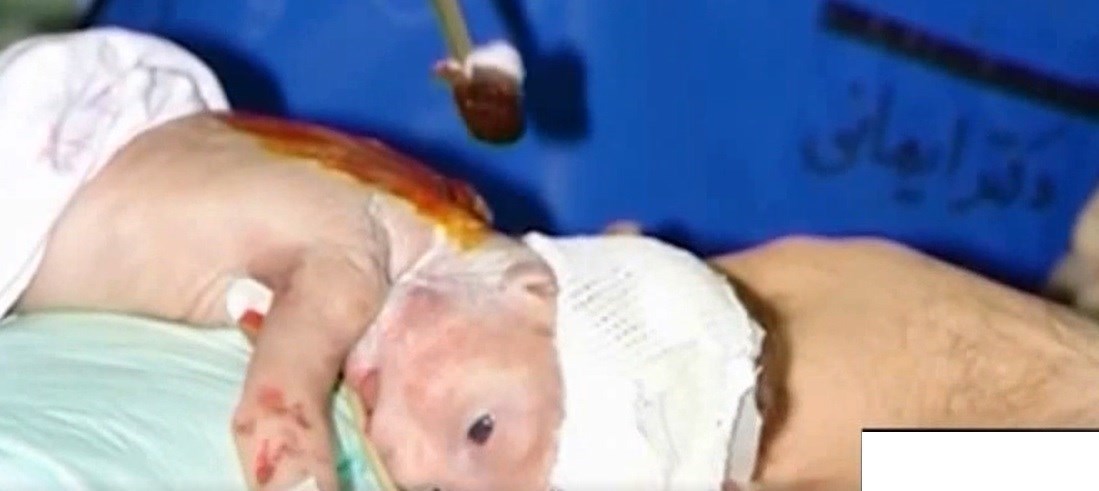 بهداشت و درمان , پزشک , جانبازان 70 درصد , 