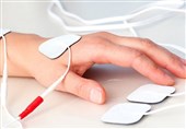 نقش فیزیوتراپی در بهبود روند درمان سوختگی
