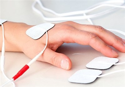 نقش فیزیوتراپی در بهبود روند درمان سوختگی