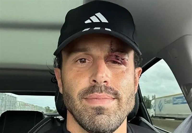 تیم فوتبال لیون فرانسه , تیم فوتبال مارسی فرانسه , لیگ لوشامپیونه فرانسه , فوتبال فرانسه , 