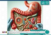 محققان ایرانی ترکیب میکروبی معده بیماران را بررسی کردند