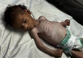 هشدار یونیسف درباره سوء تغذیه شدید 13 هزار کودک در غزه