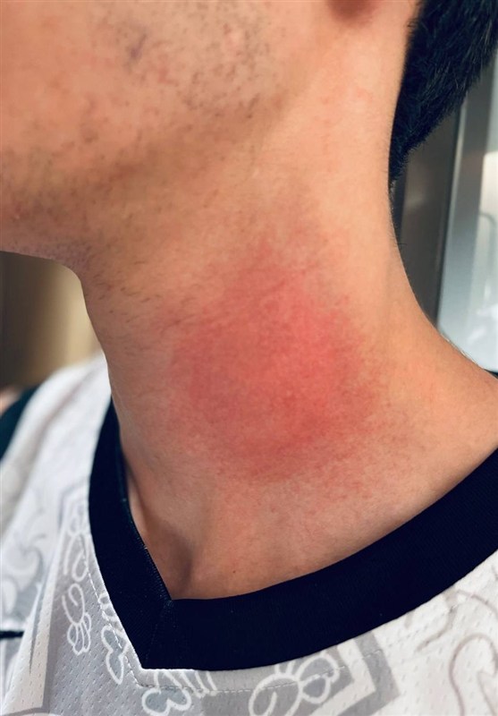 تکواندو , تکواندو ایران , مسابقات جهانی تکواندو , مهدی حاجی‌موسایی , 