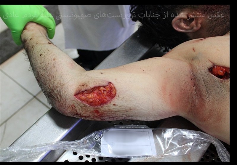 اغتشاشات 1404 , 