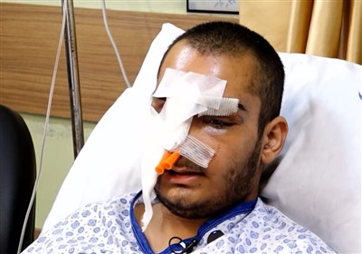 بدون تعارف با جوان مجروح از حوادث تروریستی اخیر