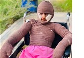 «هدا»، دختری از میناب/ مستندی درباره یکی از بازماندگان جنگ رمضان