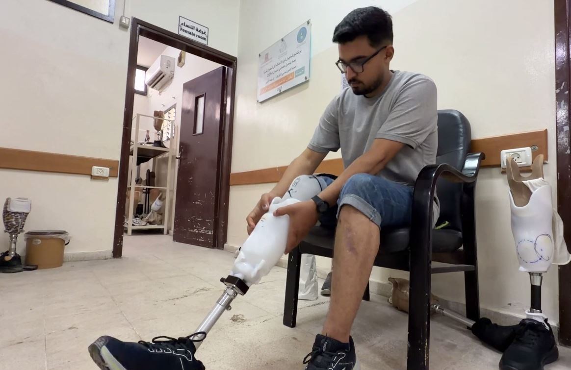مبتوري الأطراف في غزة , غزة , الجرائم الإسرائيلية في غزة , مستشفيات غزة , الجرحى والمرضى في غزة , الإبادة الجماعية في غزة , حصار غزة ,