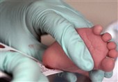 غربالگری تیروئید 25 هزار نوزاد در البرز