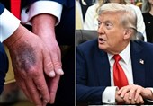 Медицинский отчёт о состоянии здоровья Трампа и вопросы, оставшиеся без ответа