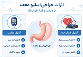 تأثیر جراحی اسلیو معده بر کنترل دیابت و فشار خون