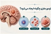 جدیدترین عوامل ایجادکننده تومور مغزی علت تومور مغزی چیست؟