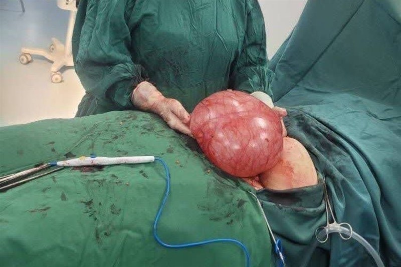 خراسان رضوی , اخبار استان خراسان رضوی , اتاق عمل جراحی , دانشگاه علوم پزشکی ایران ,