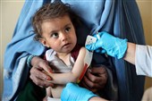 سازمان ملل: 100 مرکز درمان سوءتغذیه کودکان در افغانستان تعطیل شد