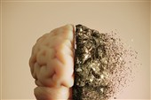 Alzheimer’s Damage May Start with Immune Signal outside Brain