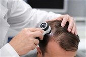 برای کاشت مو عجله نکنید؛ شاید راه ساده‌تری برای پرپشت شدن مو باشد